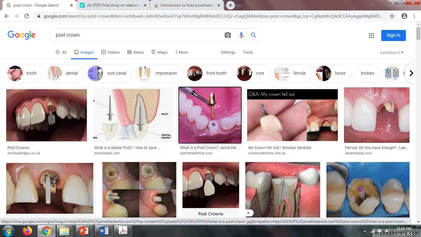 fixed prosthodontics