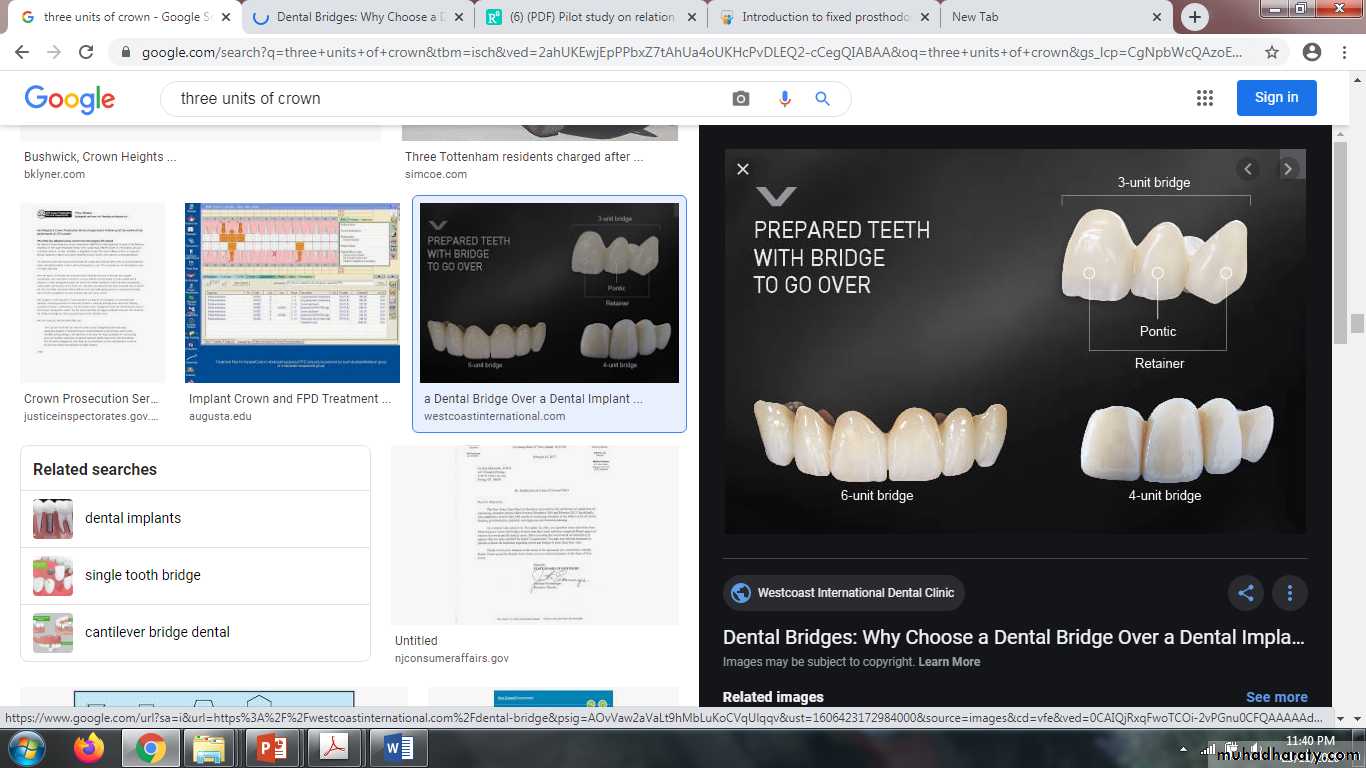 fixed prosthodontics