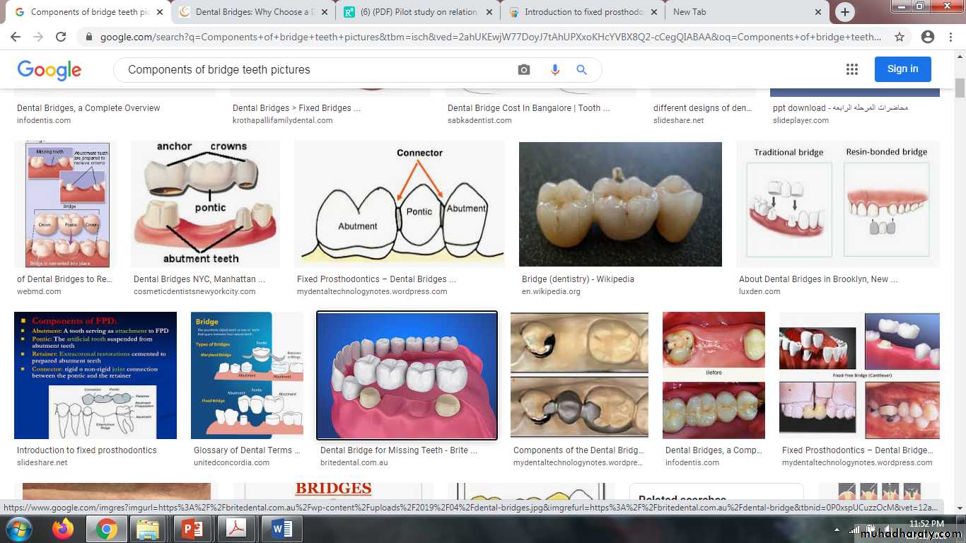 fixed prosthodontics