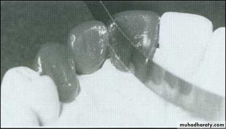 fixed prosthodontics