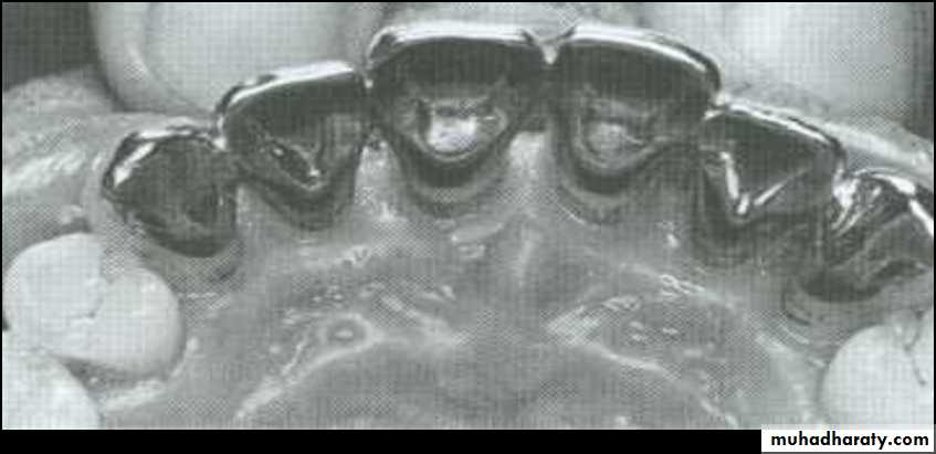 fixed prosthodontics