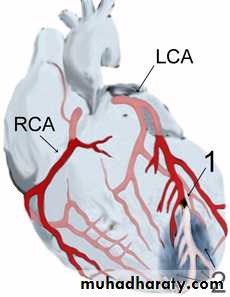 Cardiovascular system