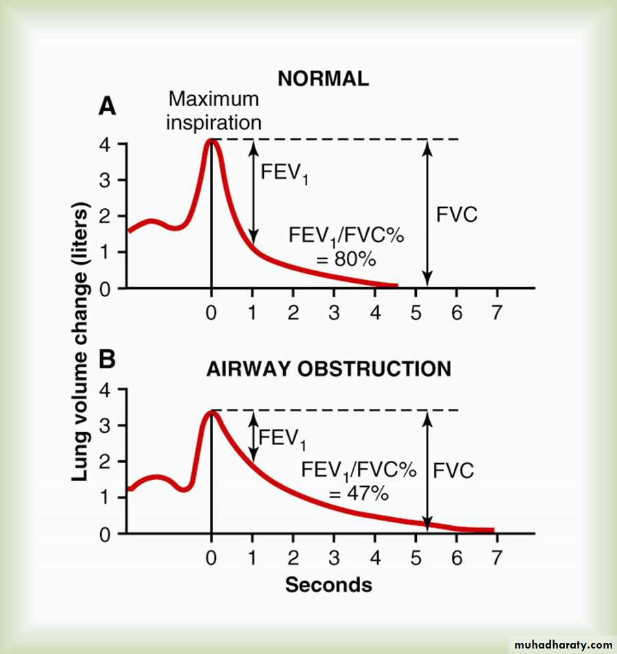 Pulmonary Functions Test