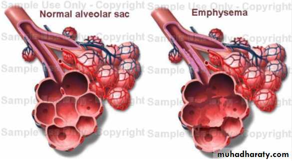 Pulmonary Functions Test