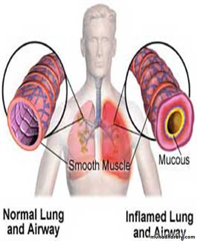 Pulmonary Functions Test