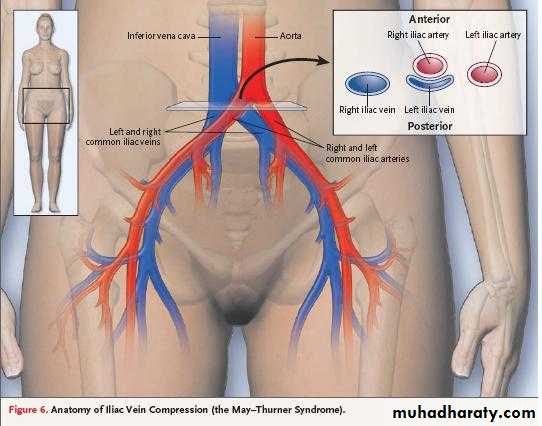 Pelvis