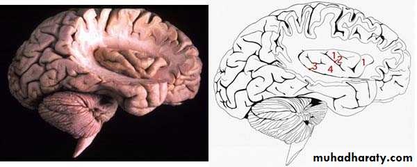 Cerebrum 2