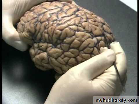Cerebrum 2