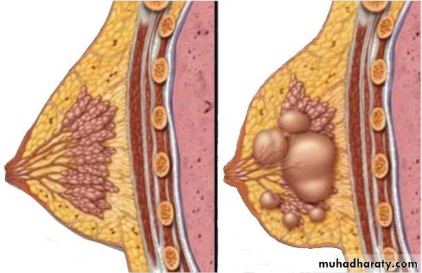 Breast
