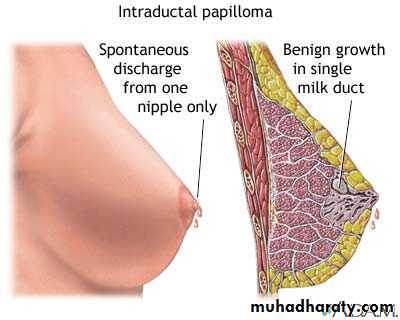 Breast