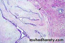 Breast