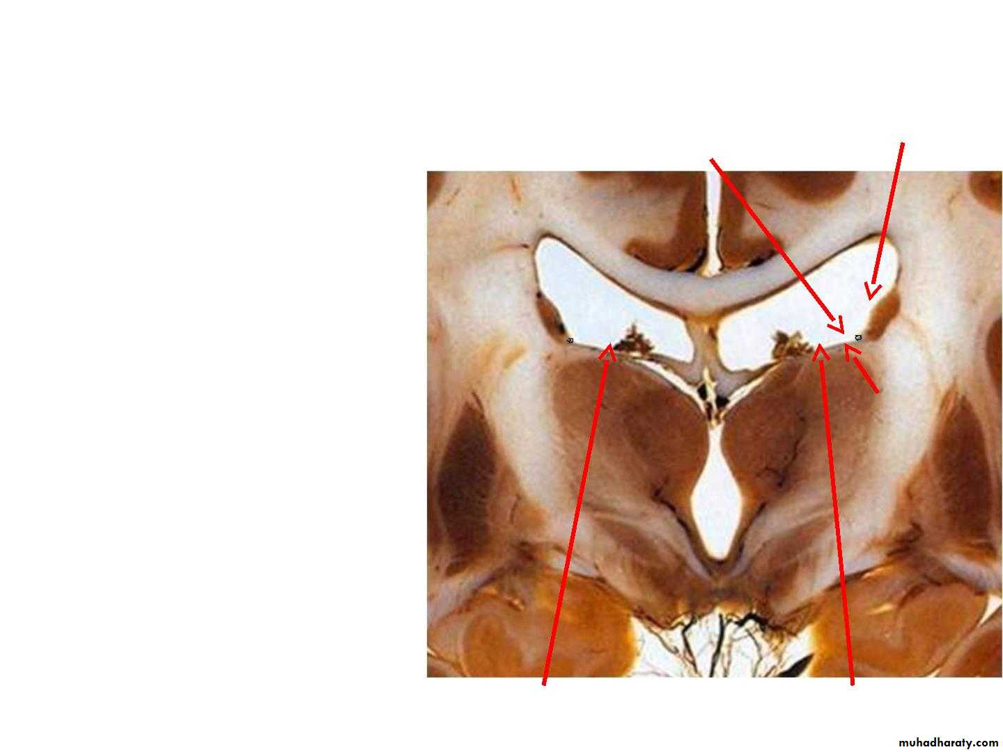 Diencephalon