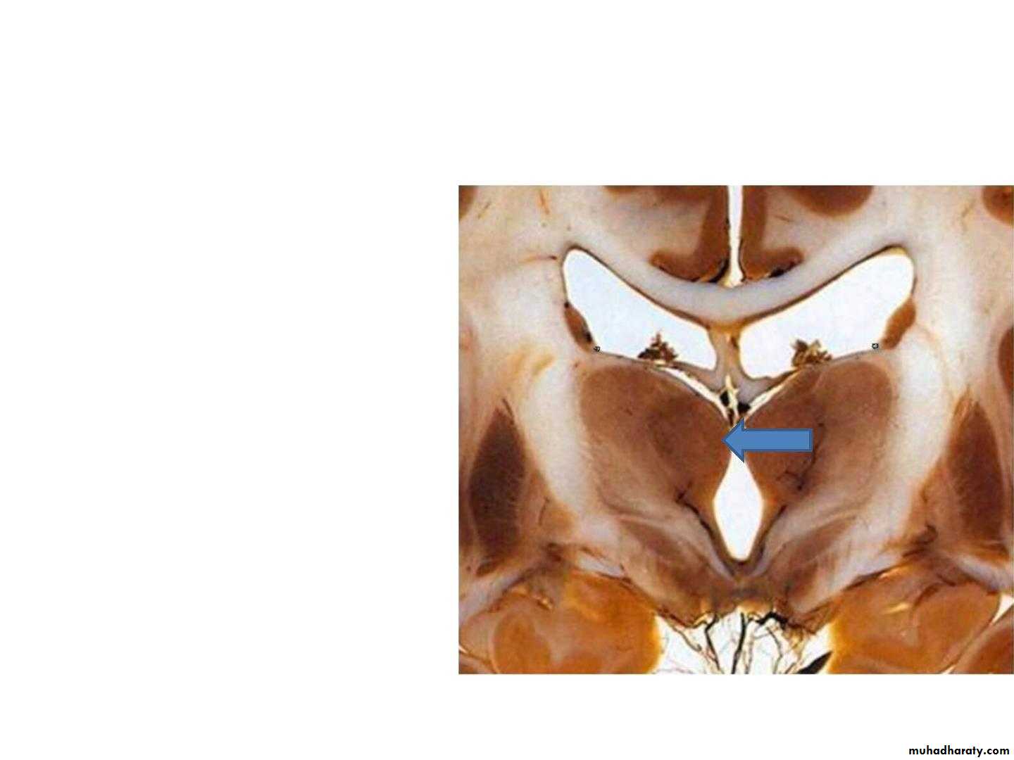 Diencephalon