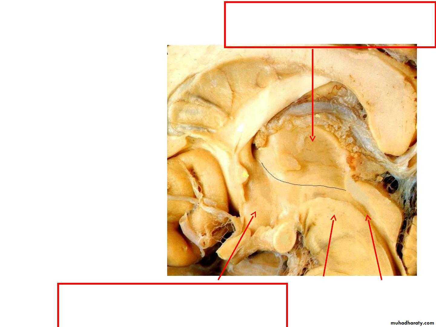 Diencephalon