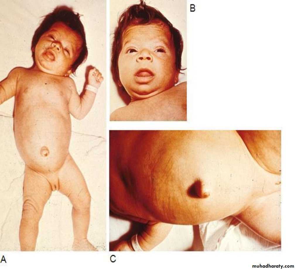 Endocrine system