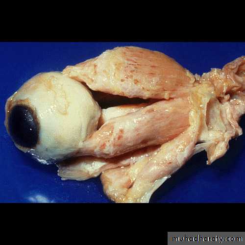 Endocrine system