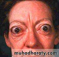 Endocrine system