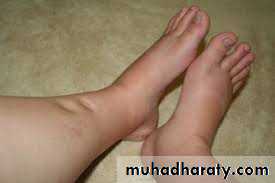 Nutritional Factors in Disease