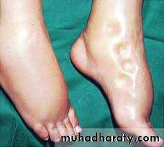Nutritional Factors in Disease