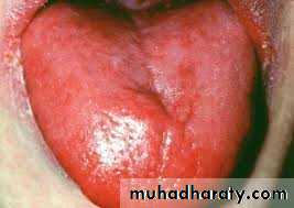 Nutritional Factors in Disease