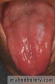Nutritional Factors in Disease
