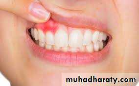 Nutritional Factors in Disease