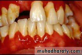 Nutritional Factors in Disease