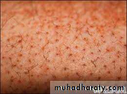 Nutritional Factors in Disease
