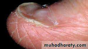 Nutritional Factors in Disease