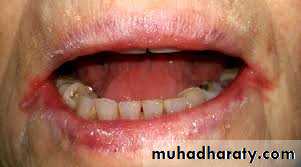 Nutritional Factors in Disease