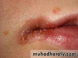 Nutritional Factors in Disease