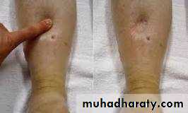 Nutritional Factors in Disease