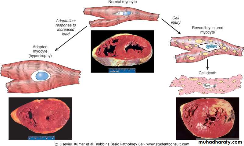 Cell Injury