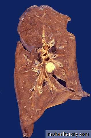 Cell Injury