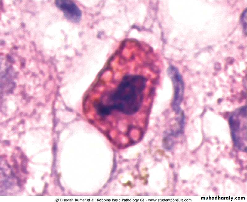 Cell Injury