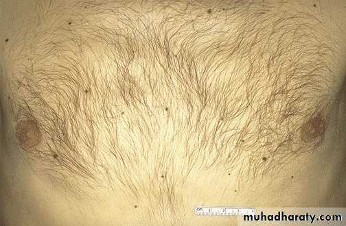 Cell Injury
