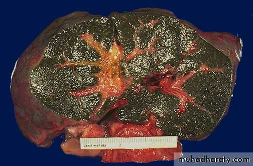 Cell Injury