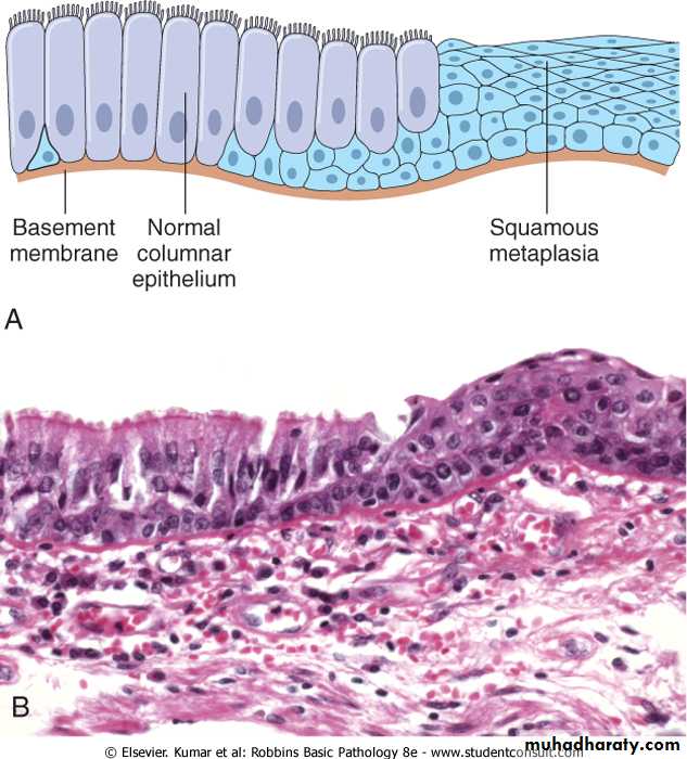 Cell Injury