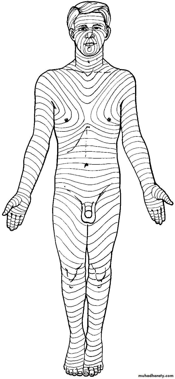 Surgical Incision