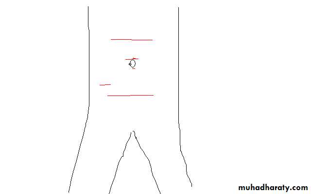 Surgical Incision