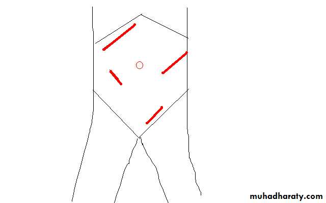 Surgical Incision