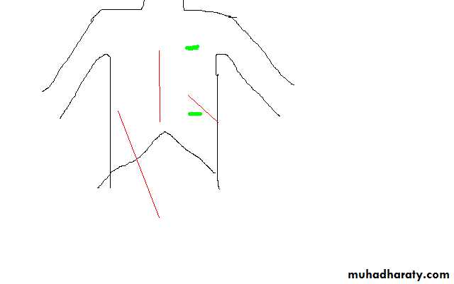 Surgical Incision