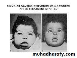 Disorder of Altered Energy Balanced Under-Nutrition Starvation and Famine