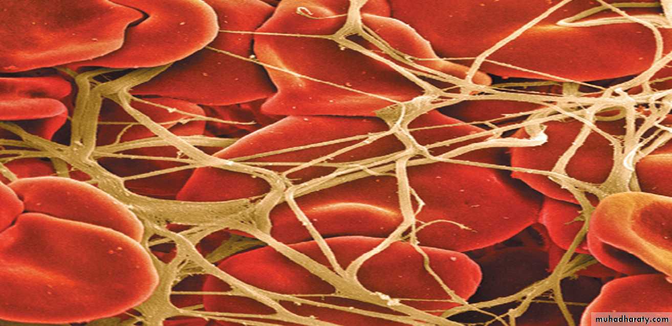 Platelet and Hemostasis