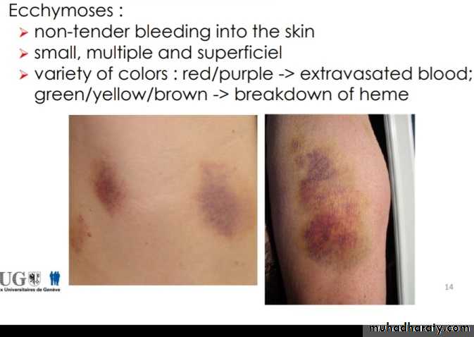 Platelet and Hemostasis