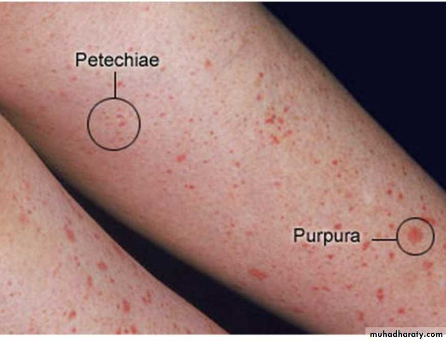 Platelet and Hemostasis