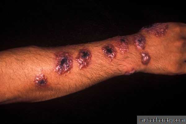 Species of Trichomonas