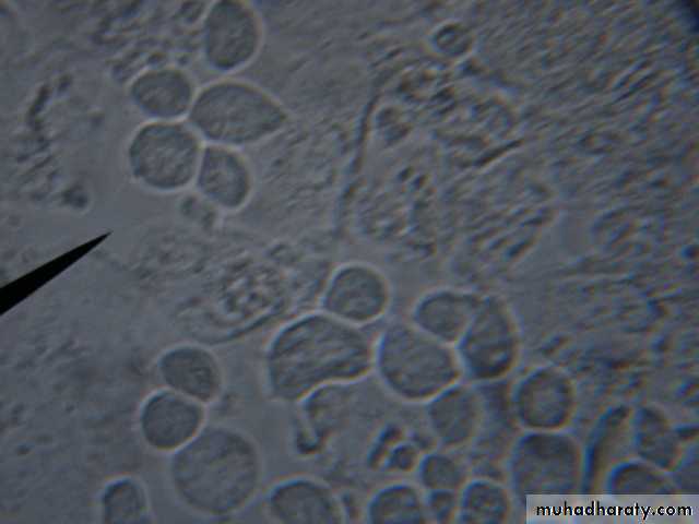 Species of Trichomonas