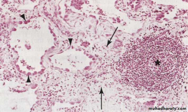 Chronic Inflammation