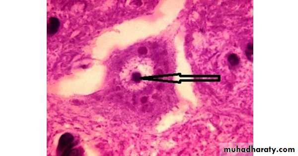 Cultivation, Detection and Quantitation of Viruses